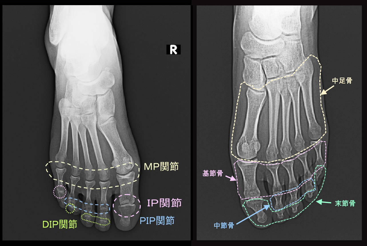足の骨格.jpg