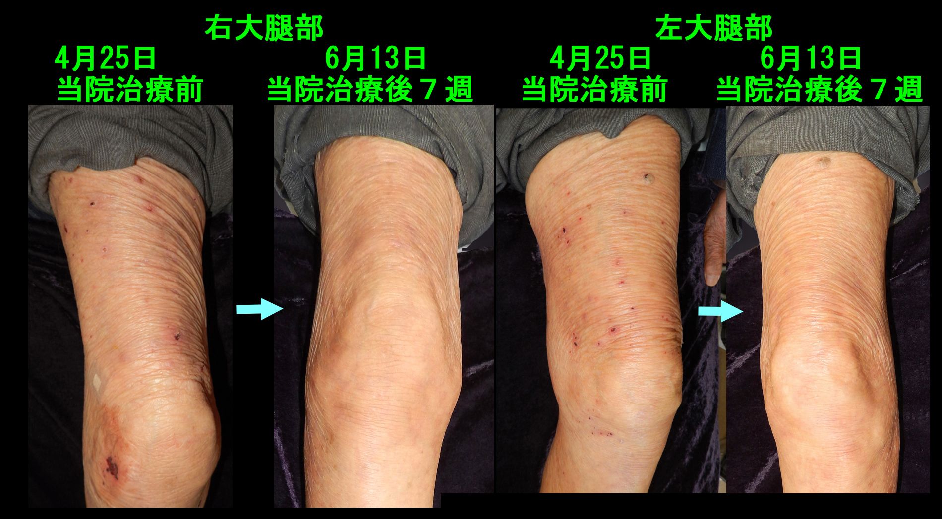 93才男　フォト４ｂ.jpg