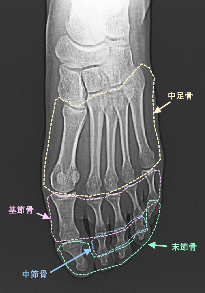 足指の骨の名称.png