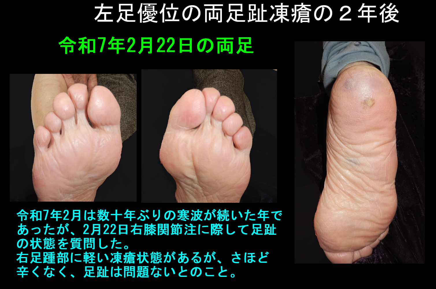 83才Ｔさん　フォト２.jpg