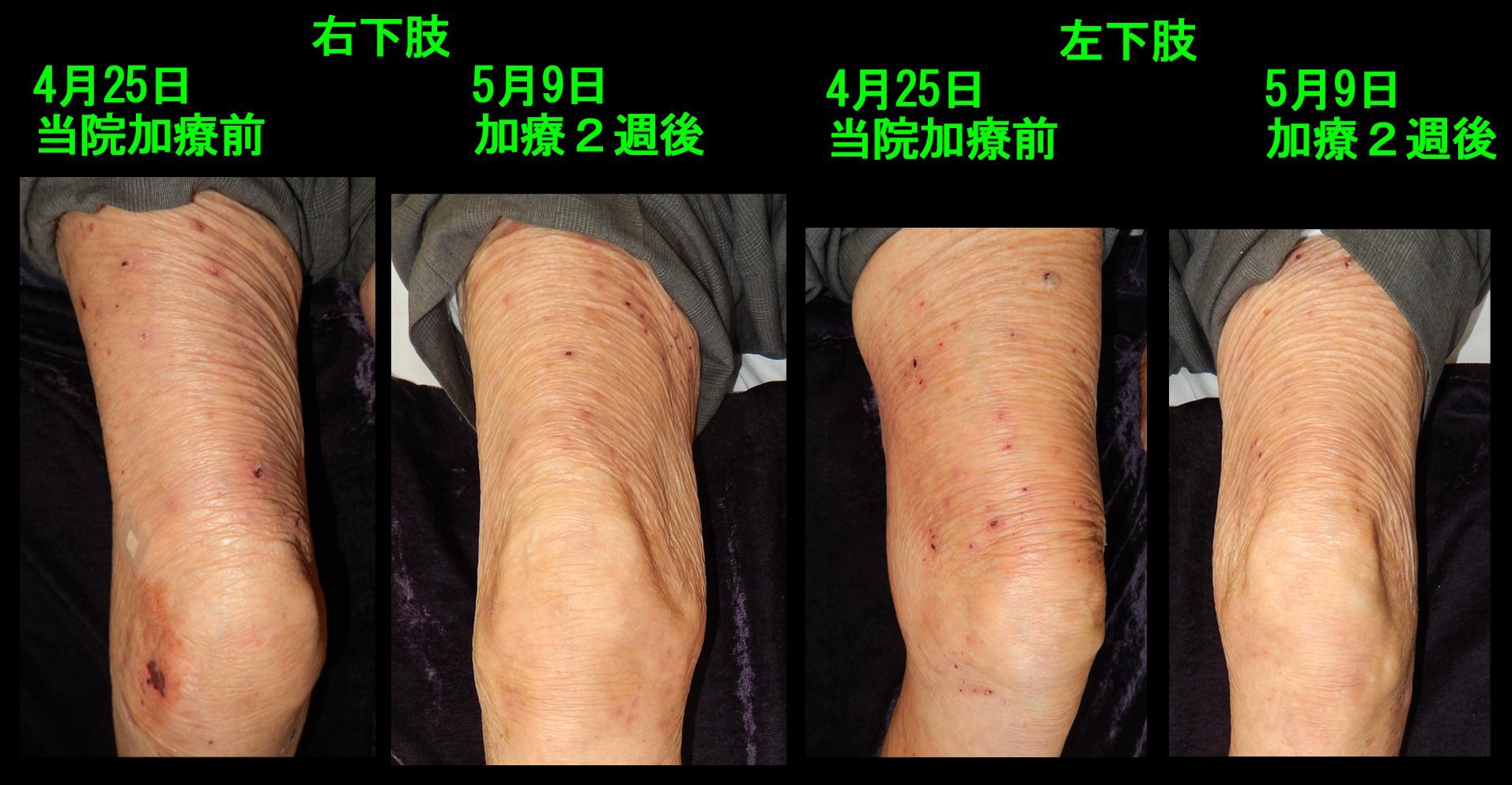 93才男　フォト３.jpg