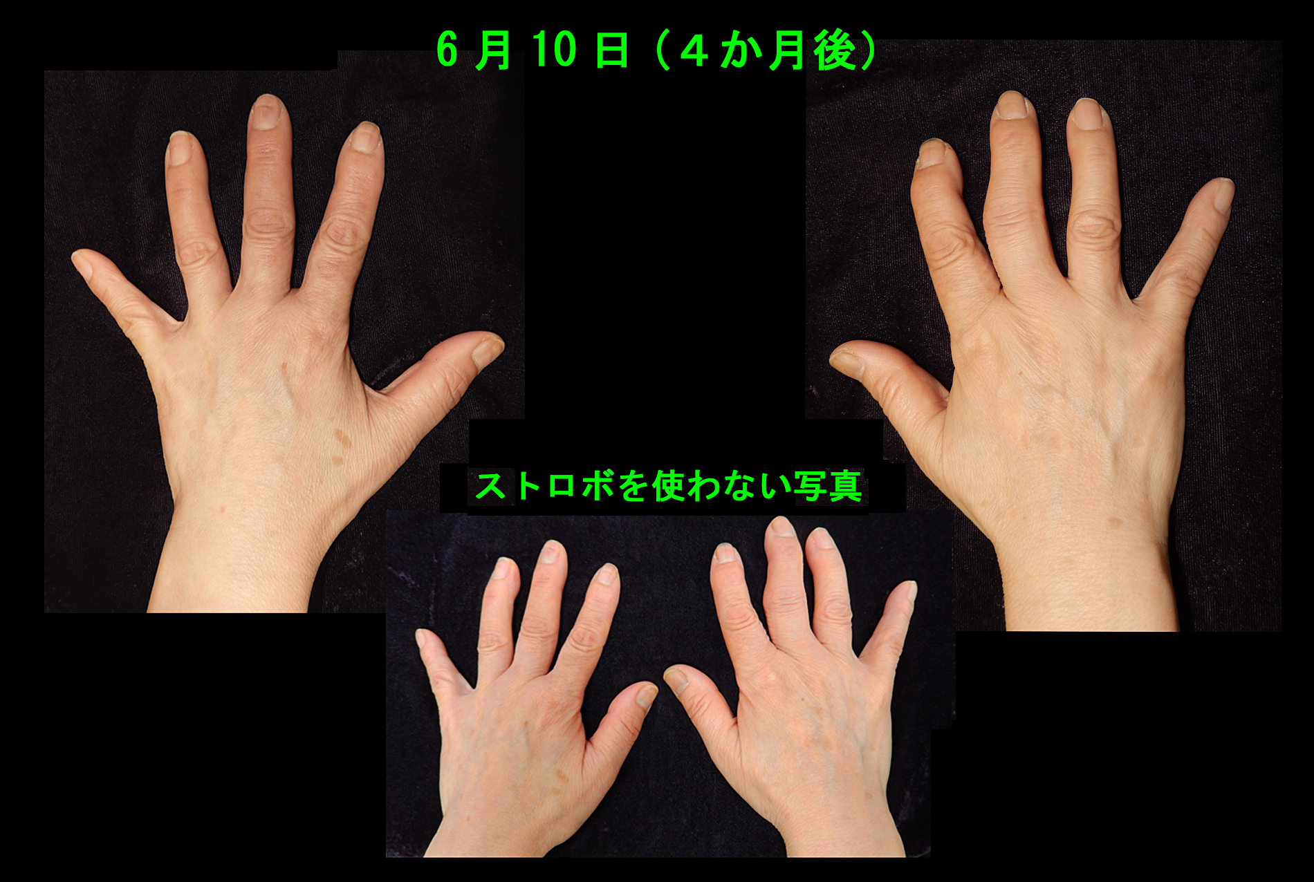 67才Aさん　フォト６.jpg