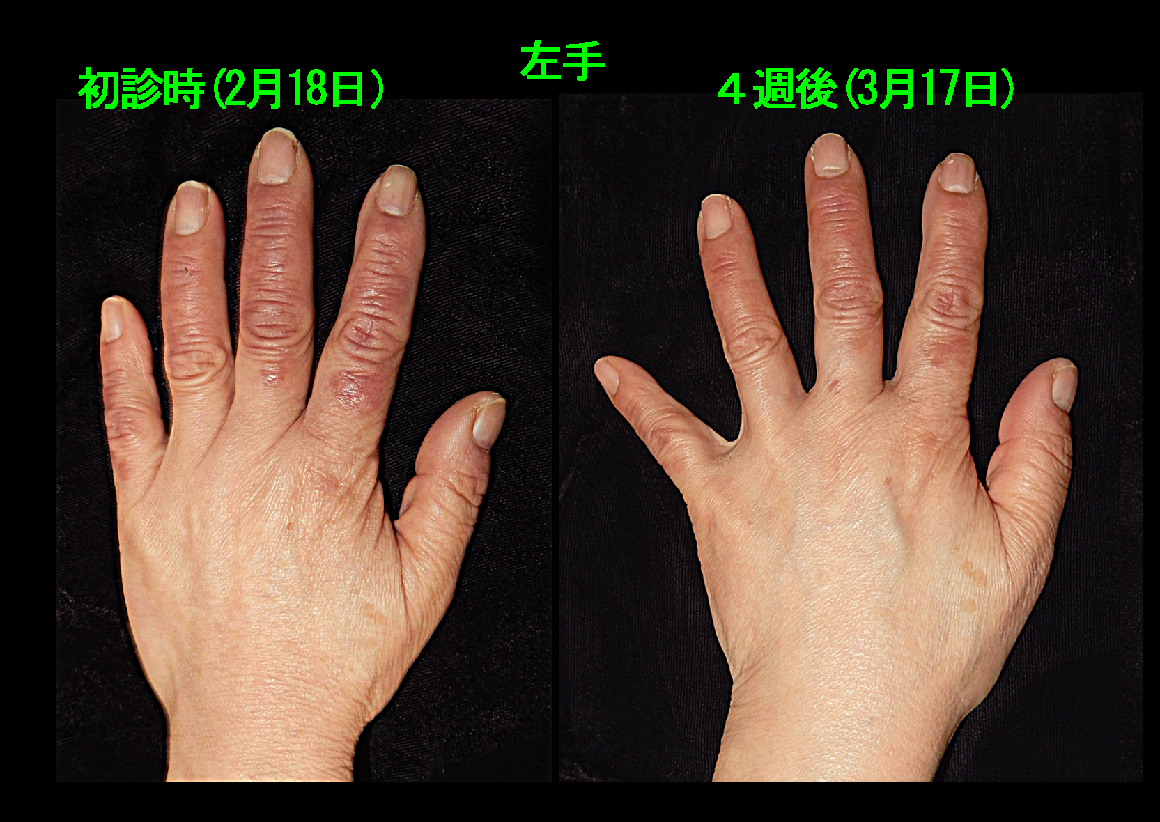 67才Aさん　フォト４.jpg