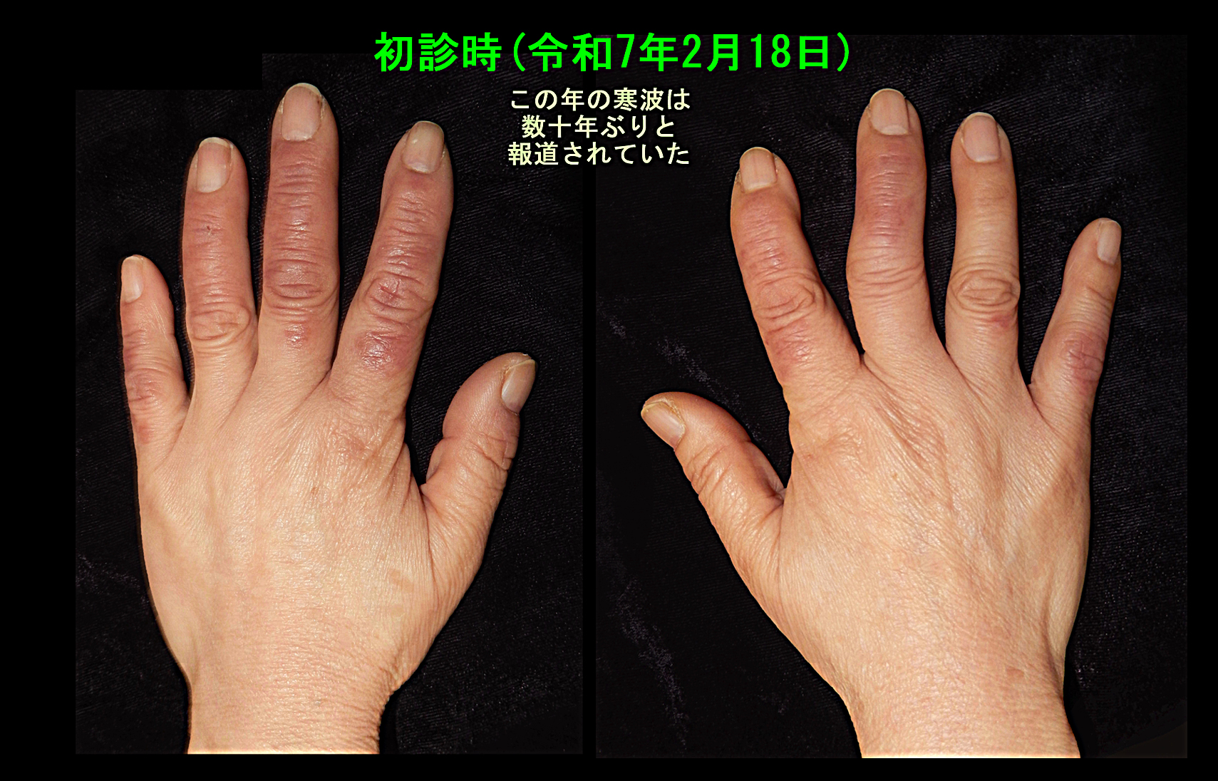 67才Aさん　フォト１.jpg