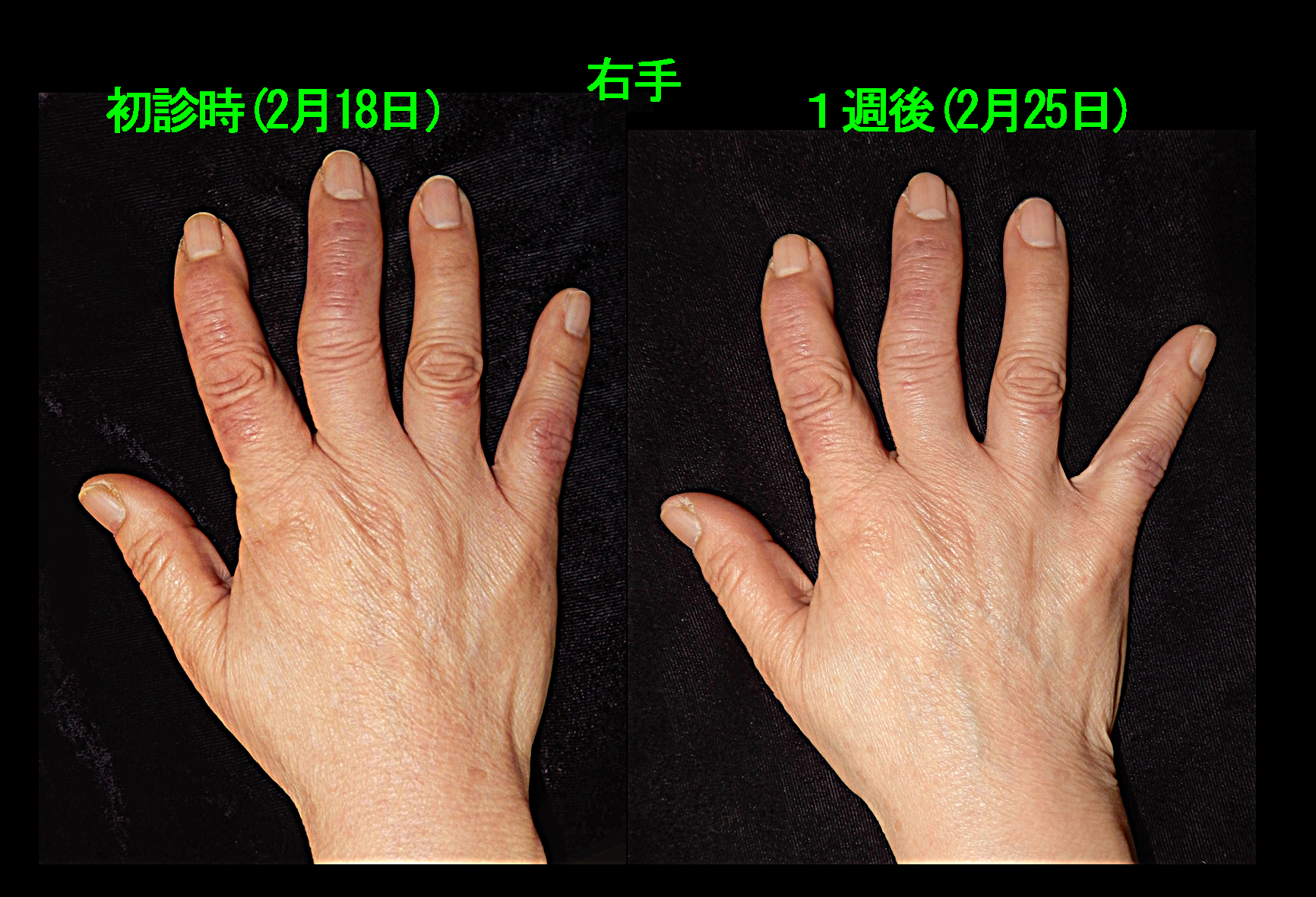67才Aさん　フォト３.jpg