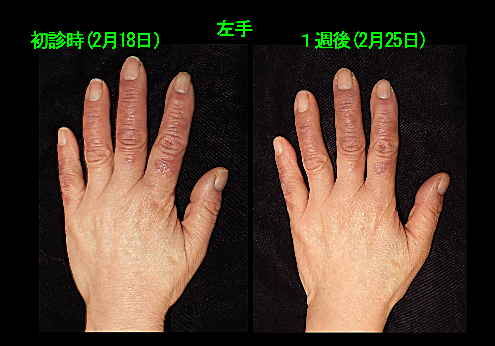 67才Aさん　フォト2.jpg