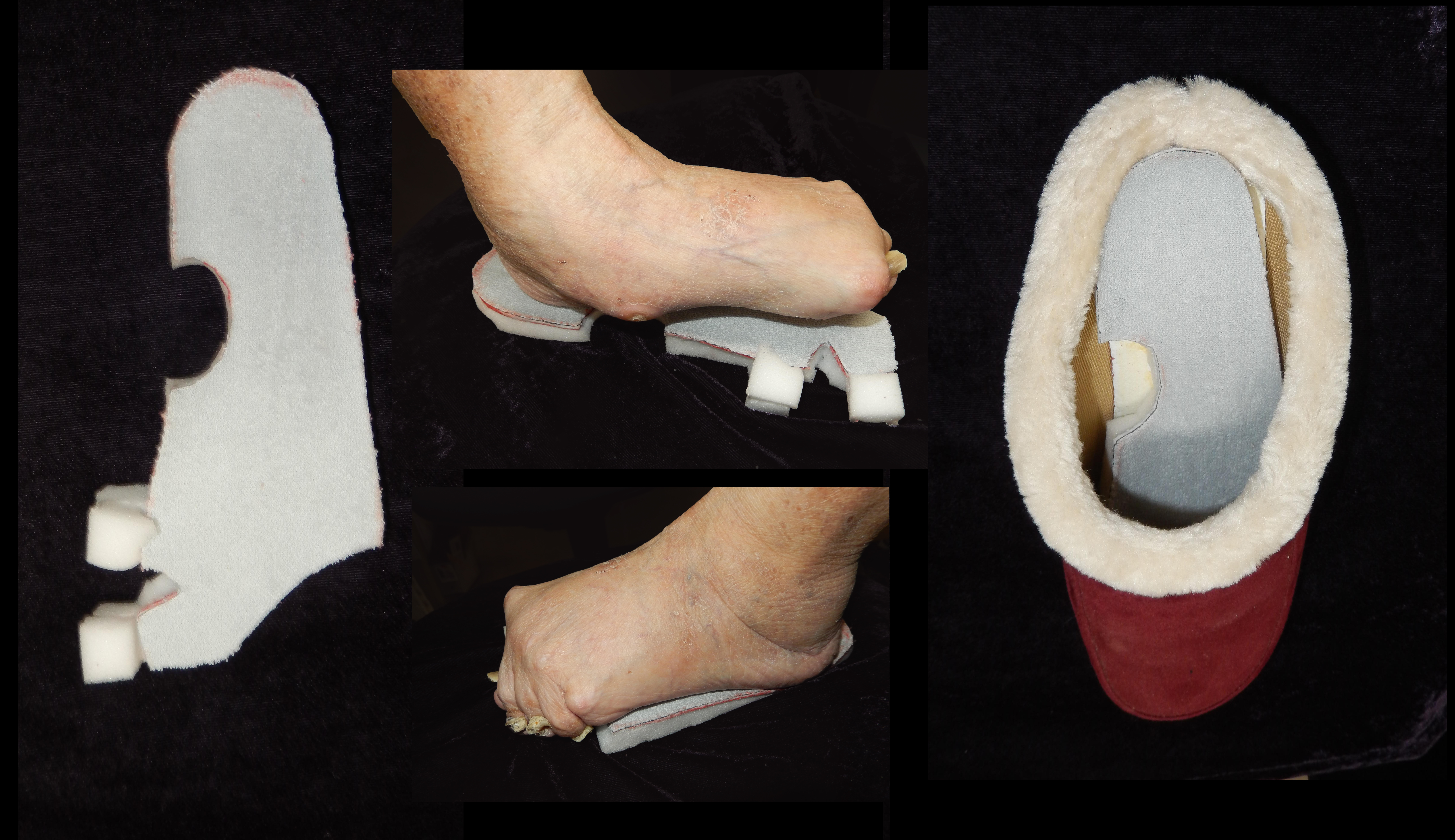 左足とインソール.jpg