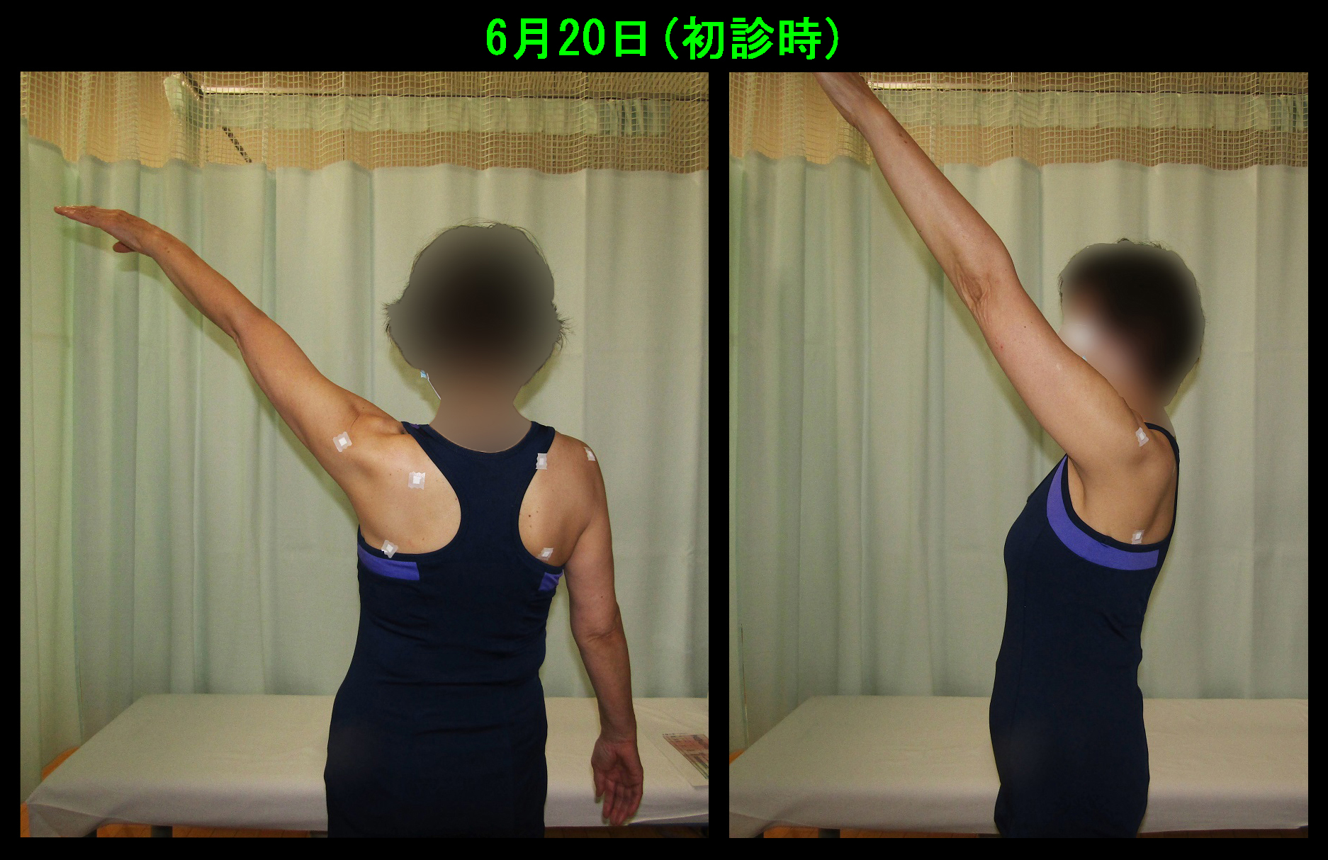 初診時.jpg