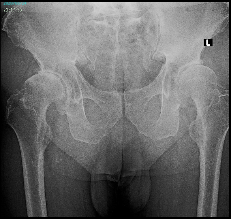 医大診断OA 1.png