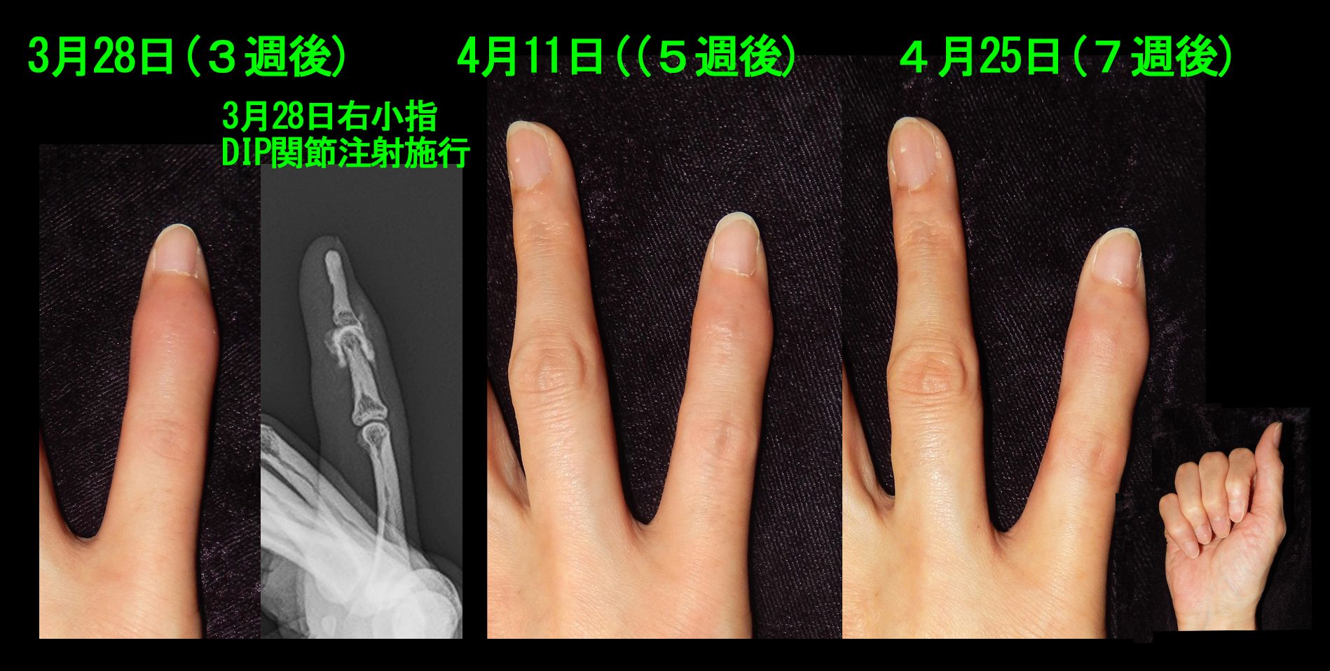 49女　2.jpg