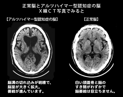 4a4cd577e17734de4c38013a8cc921df8f4bffec.png