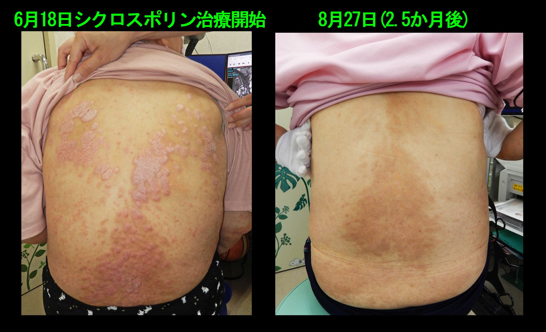 68才女　フォト３.jpg