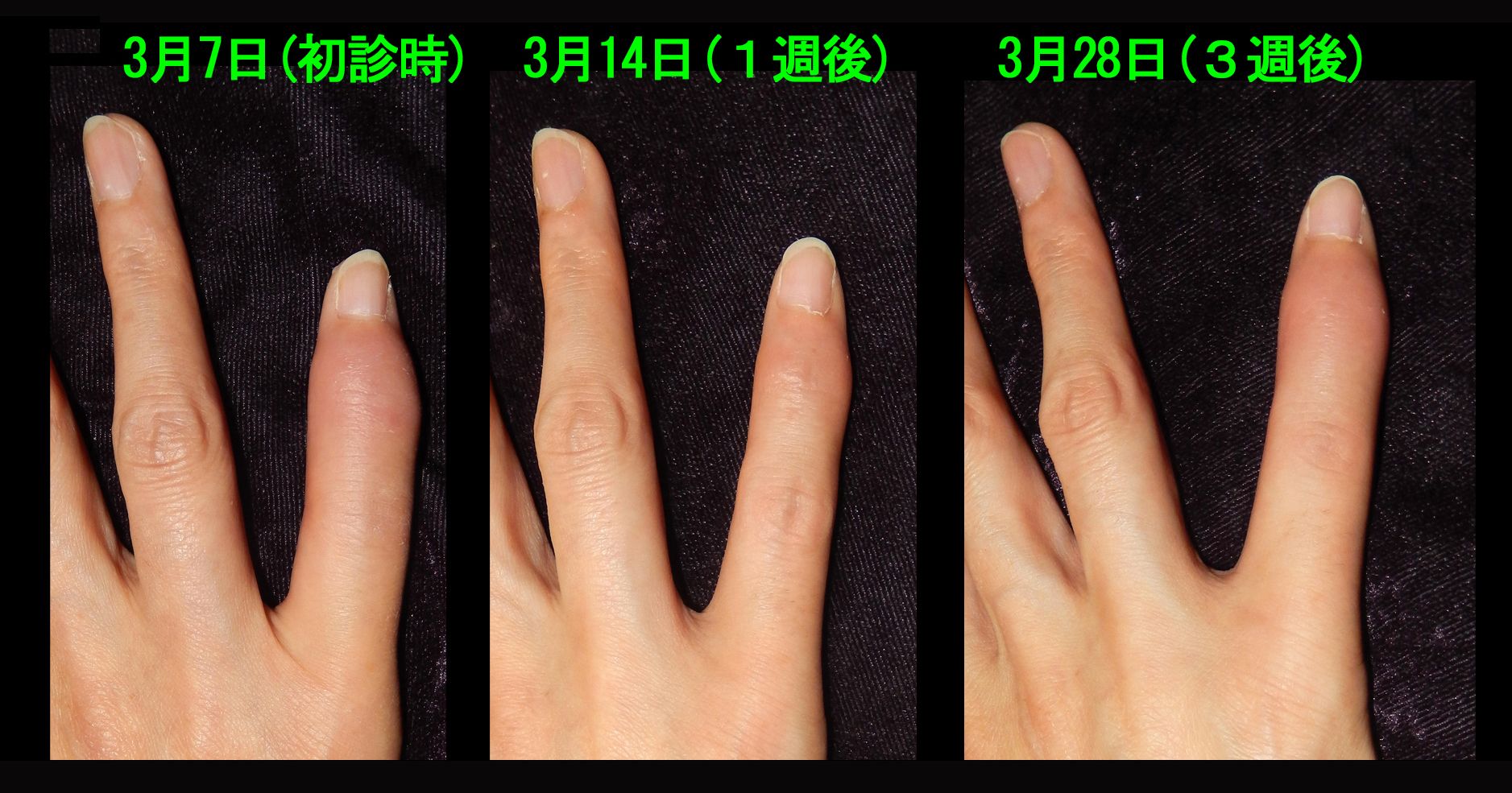 49女　１.jpg