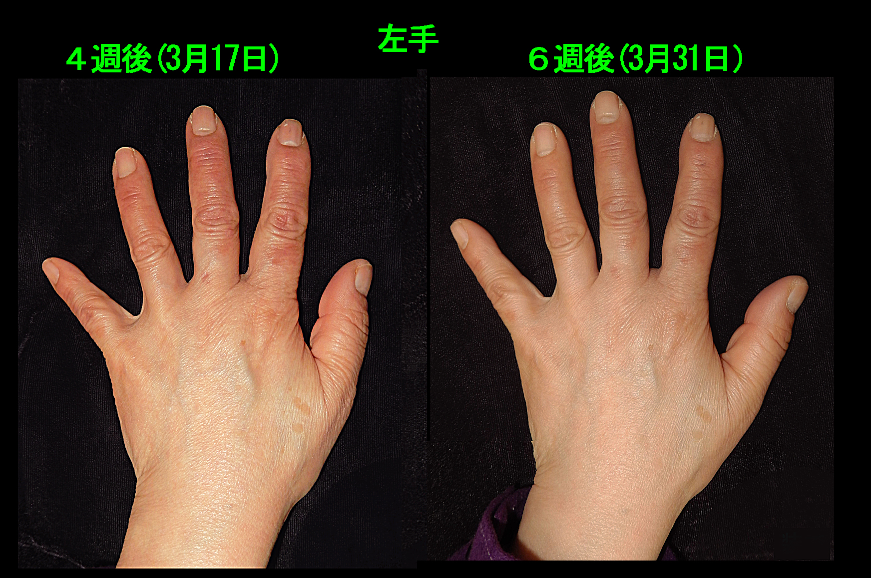 67才Aさん　フォト５.jpg