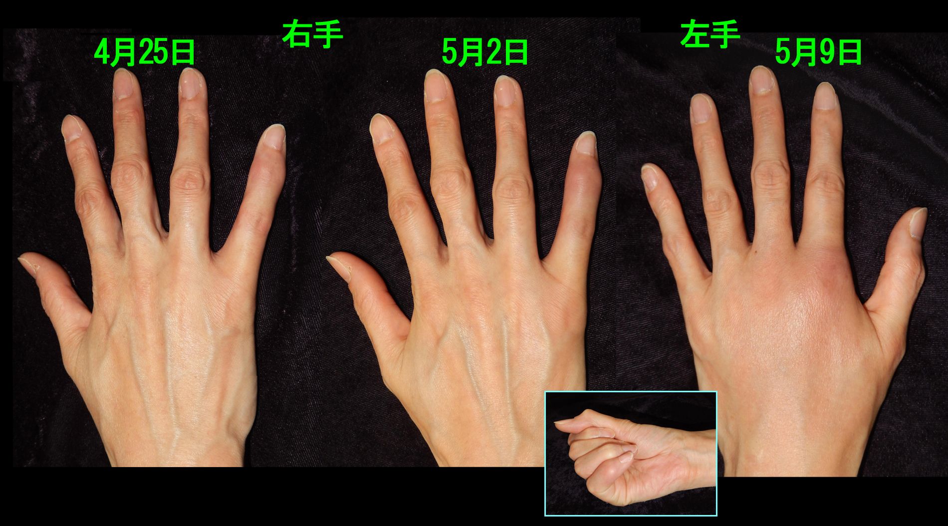 49女　３.jpg