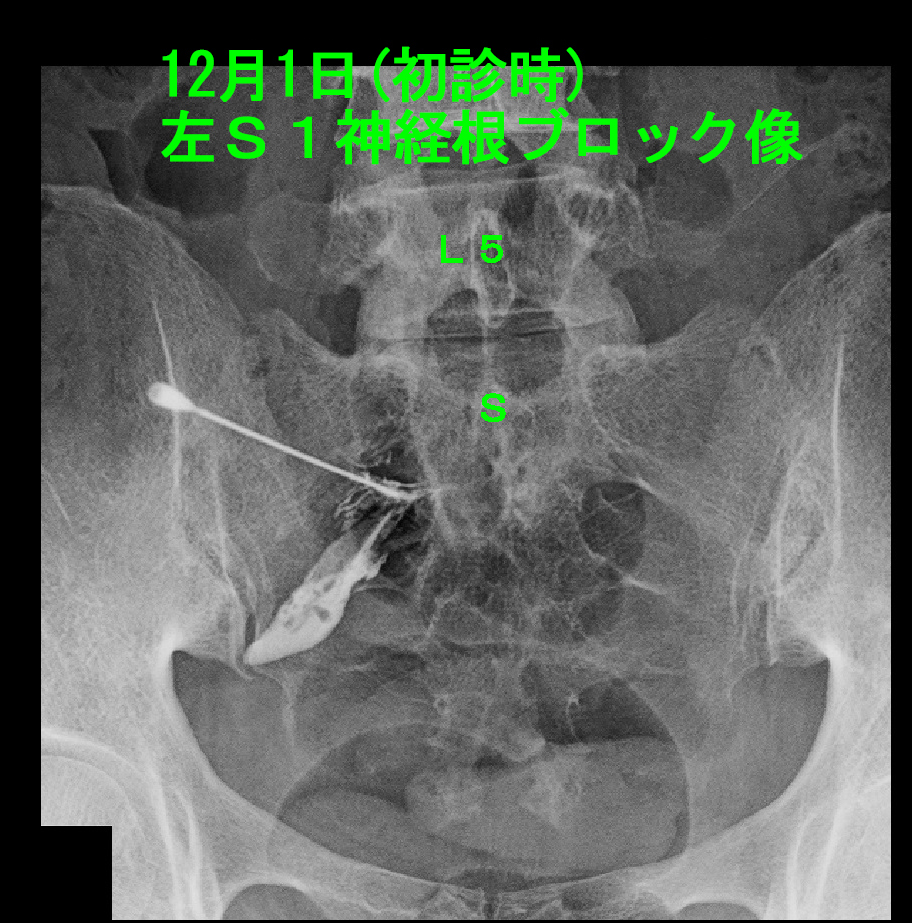 52才女　Xp２.jpg