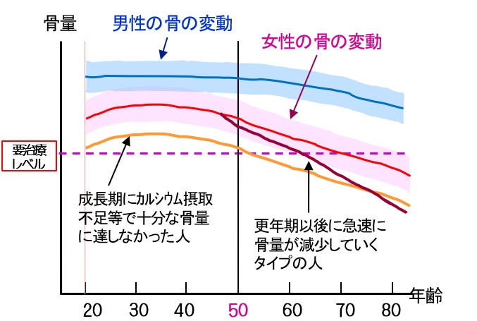 骨量の推移グラフ.jpg