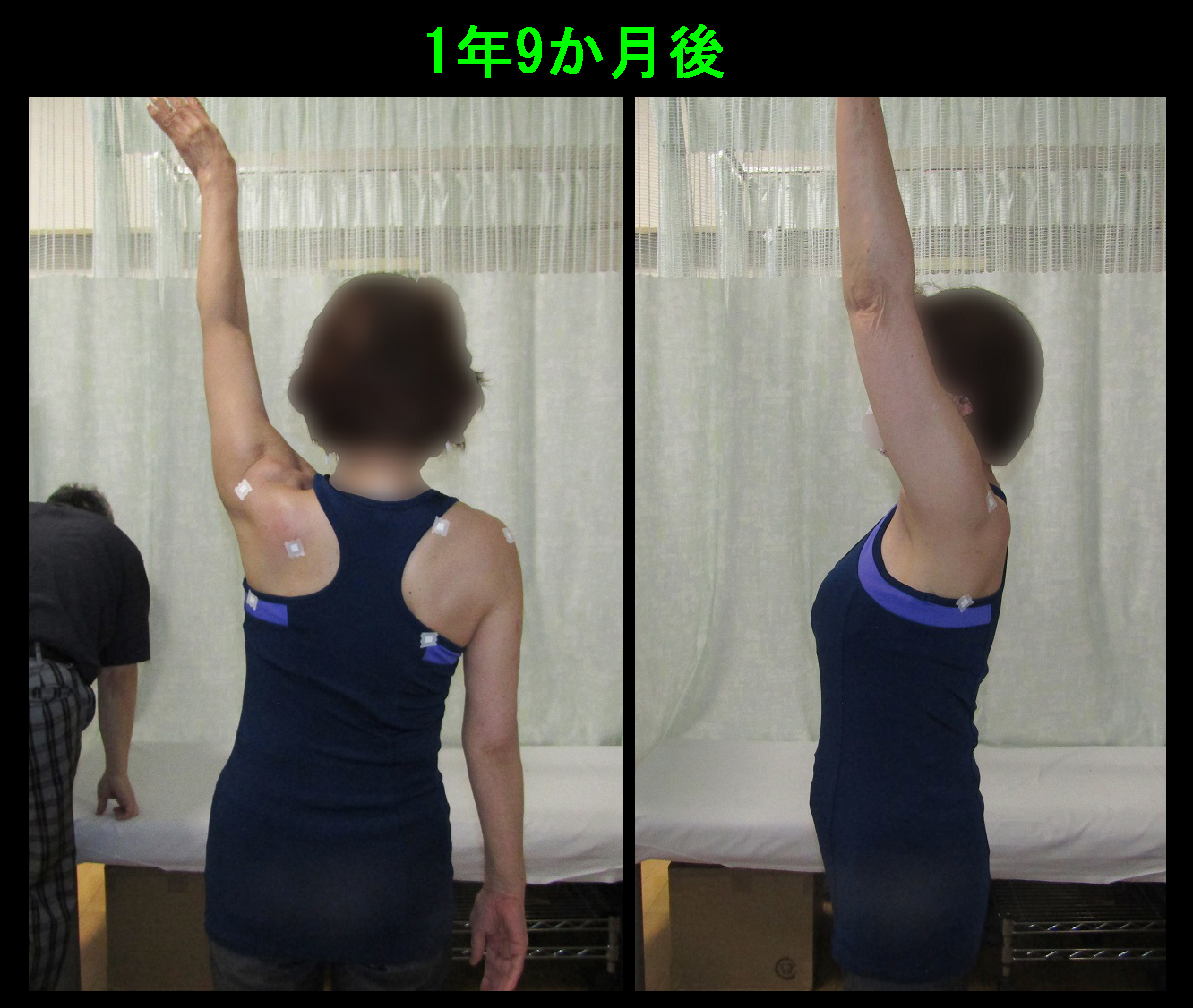 1年9か月後.jpg
