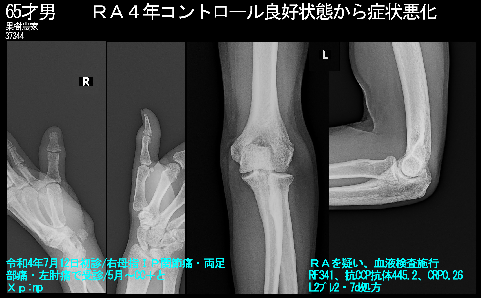 010.jpg