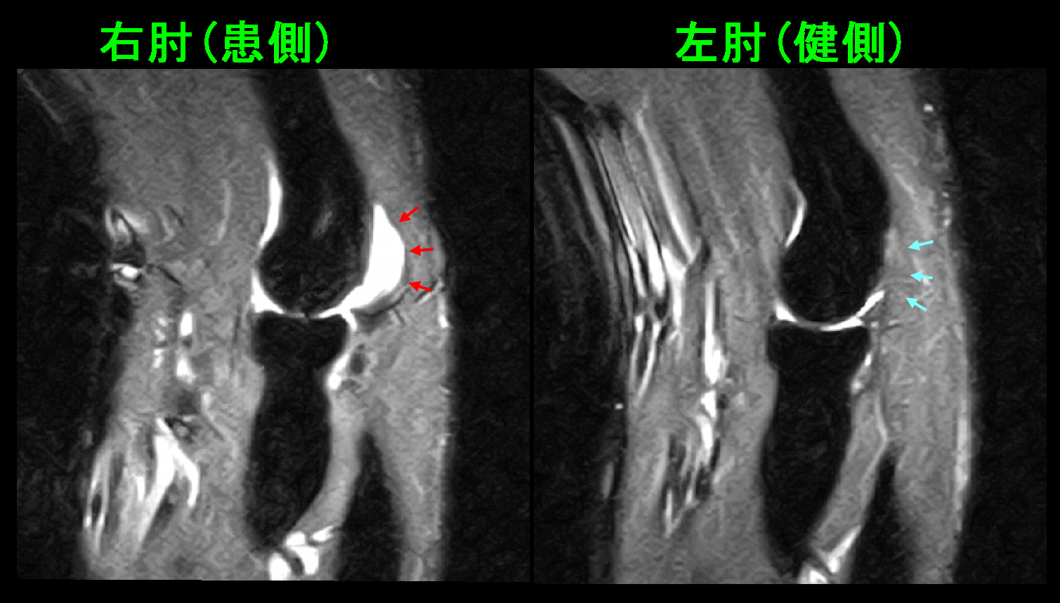 46才男ボクシングMRI１.jpg