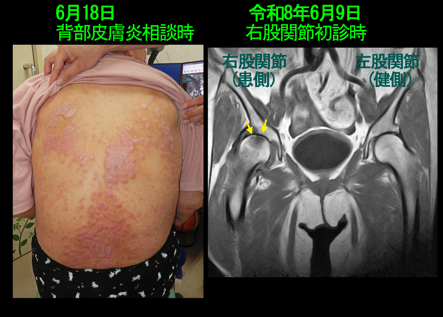 68才女　フォト１.jpg