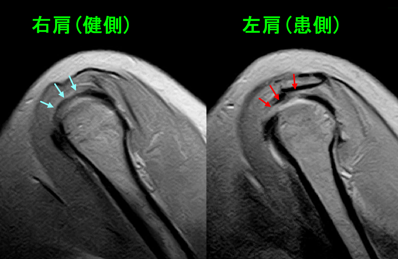 サイレントマニュピュレーション・MRI.jpg