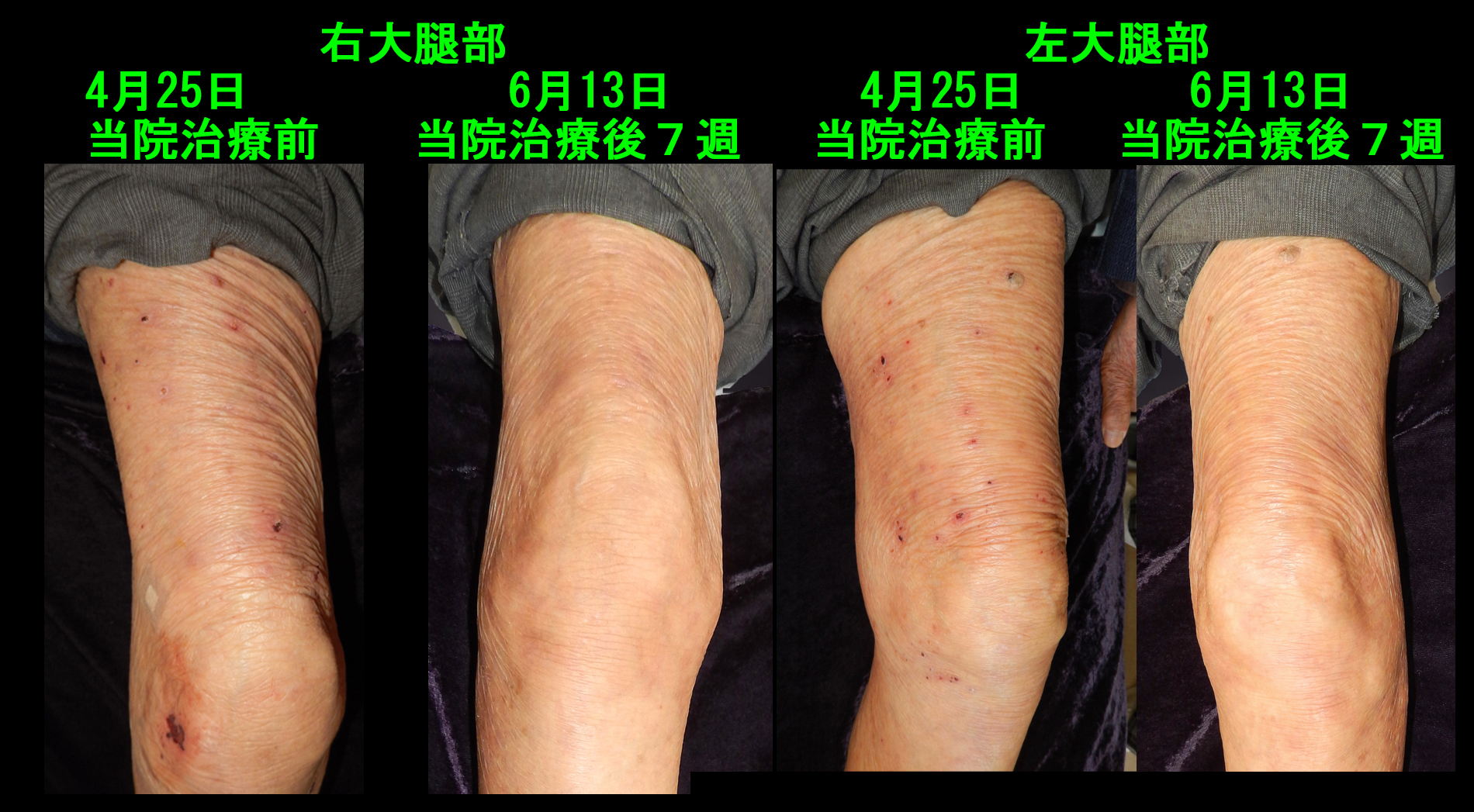 93才男　フォト４.jpg